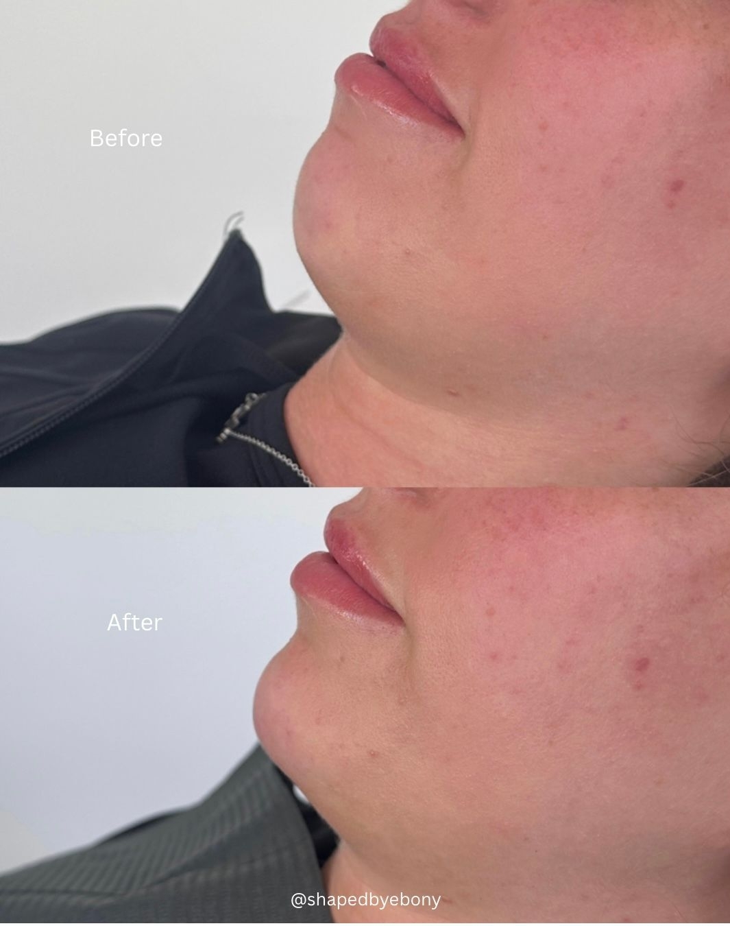 Shaped By Ebony Before And After 02 Xlarge