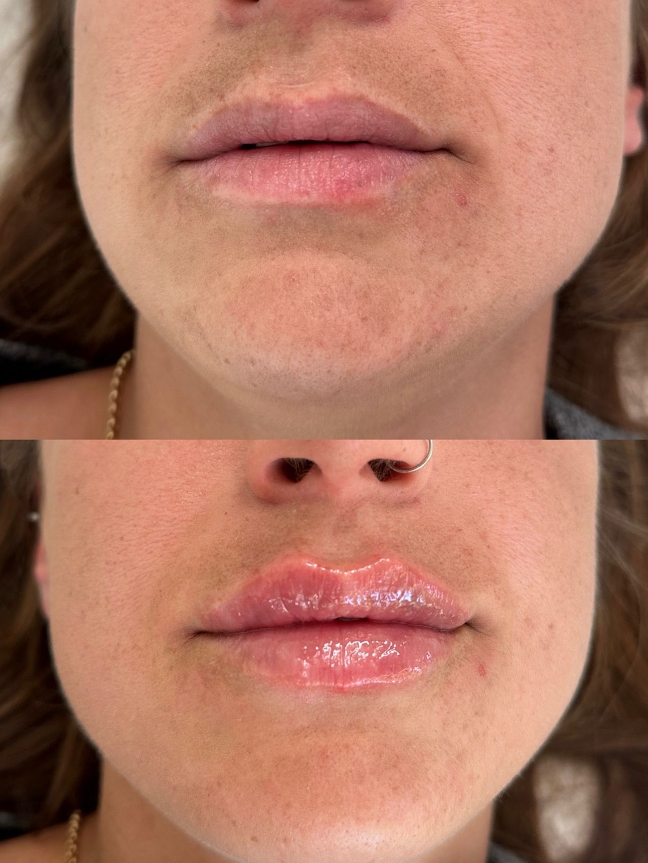 Shaped By Ebony Before And After 04 Xlarge