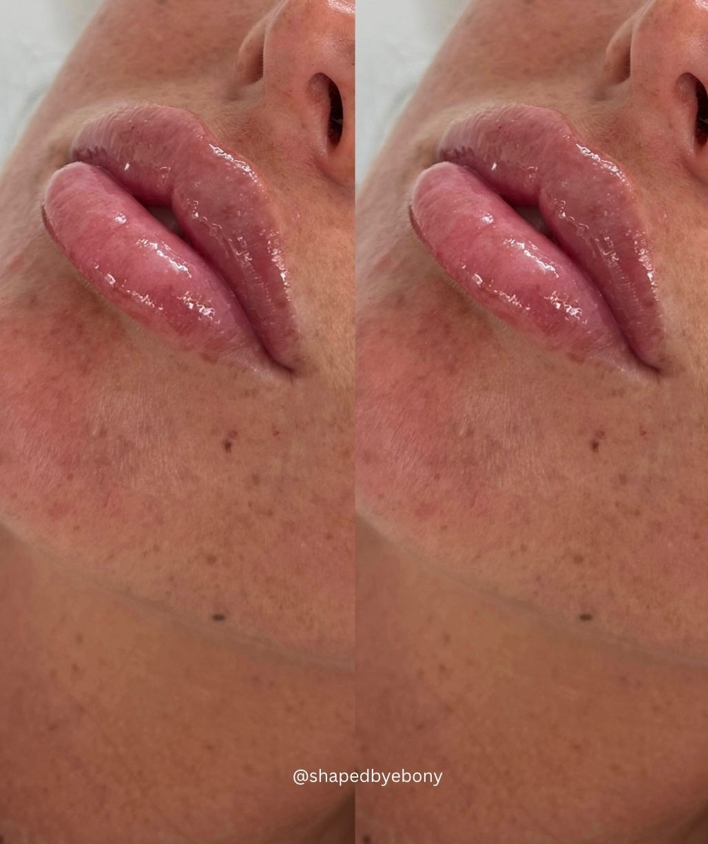 Shaped By Ebony Before And After 10 Xlarge