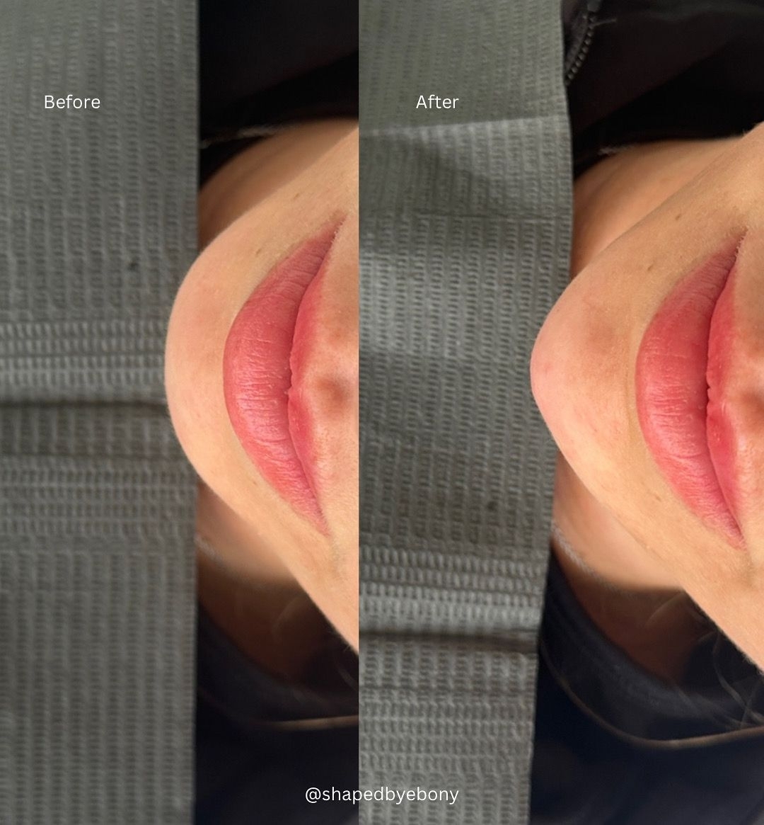 Shaped By Ebony Before And After 11 Xlarge