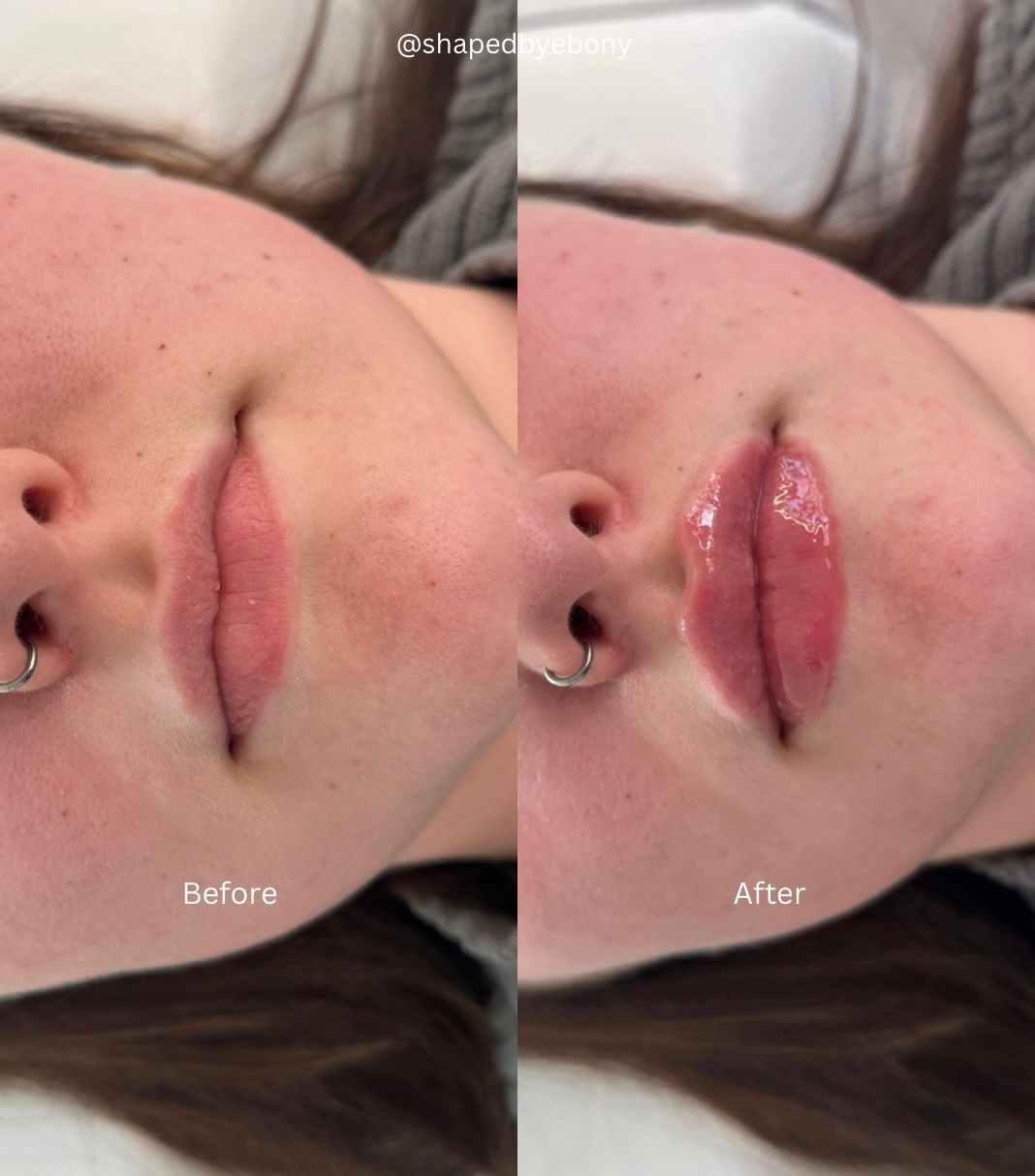 Shaped By Ebony Before And After 12 Xlarge
