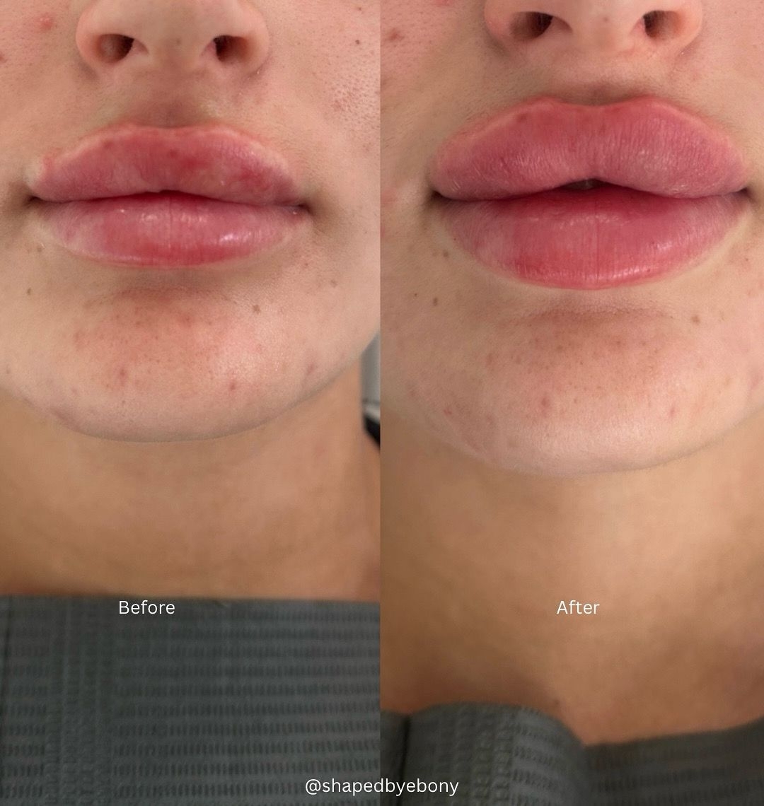Shaped By Ebony Before And After 13 Xlarge