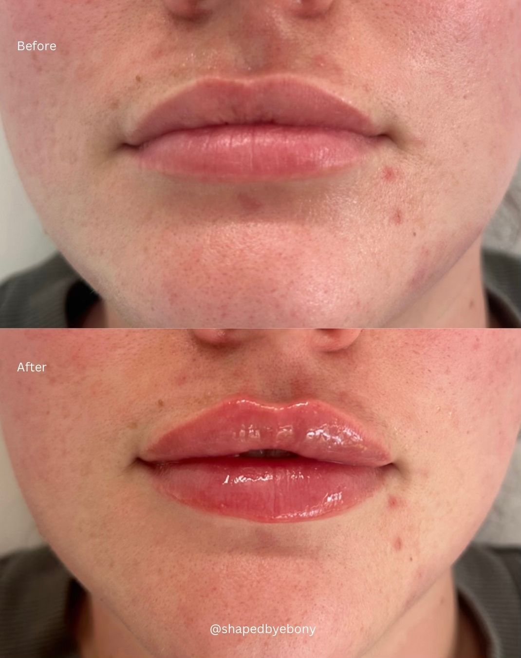 Shaped By Ebony Before And After 15 Xlarge